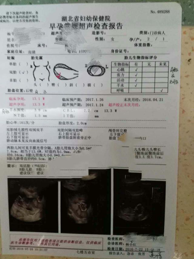 ���ݴ���